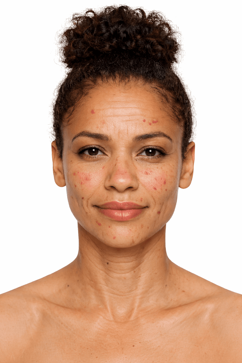 Before — aging skin